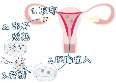 生殖中心